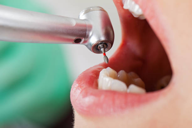 Best Emergency Dental Care for Broken or Chipped Teeth in Atwood, KS